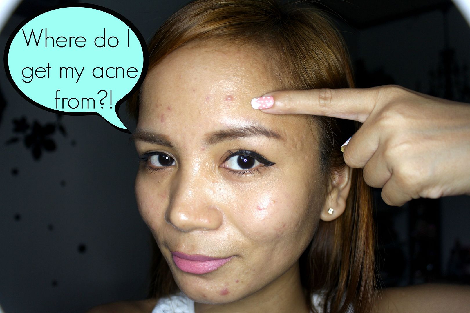 Things That Cause Your Acne! Beauty And Fashion